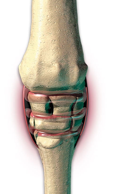 inflamemd joint